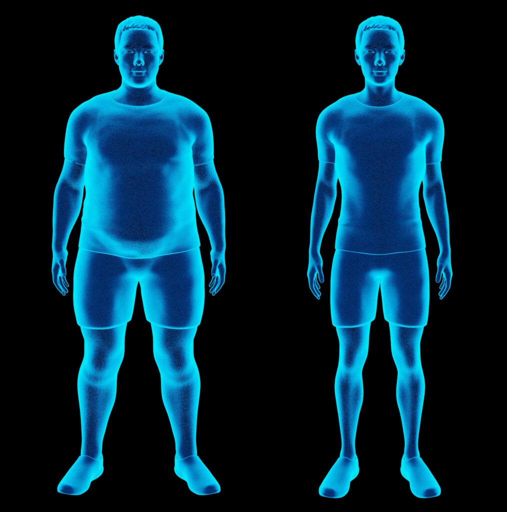 cryotherapy weight loss difference