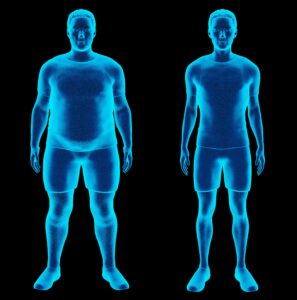 cryotherapy weight loss difference